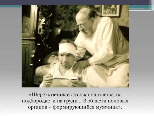 «Шерсть осталась только на голове, на подбородке и на груди… В области