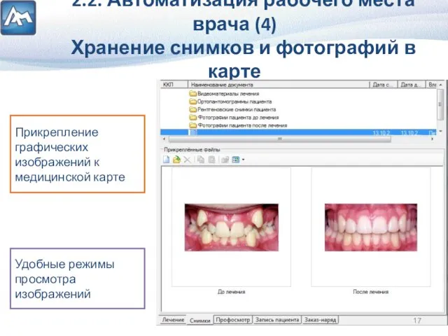 2.2. Автоматизация рабочего места врача (4) Хранение снимков и фотографий в карте