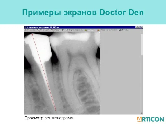 Примеры экранов Doctor Den Просмотр рентгенограмм