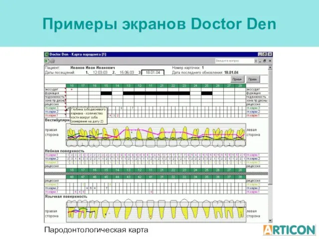 Примеры экранов Doctor Den Пародонтологическая карта