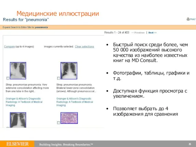 Медицинские иллюстрации Быстрый поиск среди более, чем 50 000 изображений высокого качества