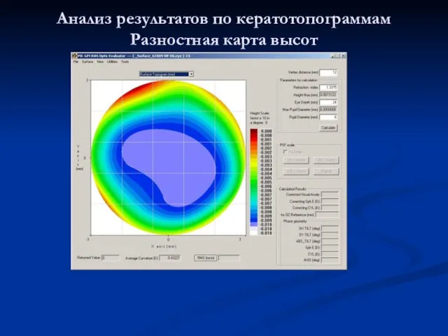 Анализ результатов по кератотопограммам Разностная карта высот