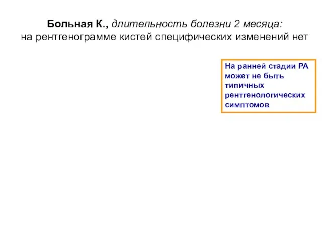 Больная К., длительность болезни 2 месяца: на рентгенограмме кистей специфических изменений нет