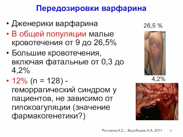 Передозировки варфарина Дженерики варфарина В общей популяции малые кровотечения от 9 до