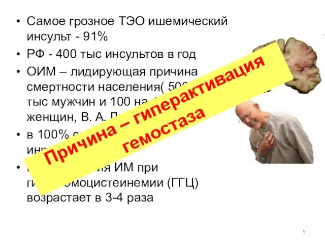 Самое грозное ТЭО ишемический инсульт - 91% РФ - 400 тыс инсультов