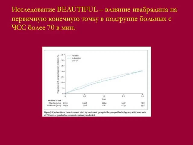 Исследование BEAUTIFUL – влияние ивабрадина на первичную конечную точку в подгруппе больных