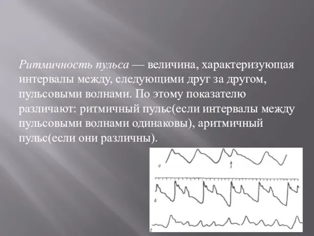 Ритмичность пульса — величина, характеризующая интервалы между, следующими друг за другом, пульсовыми