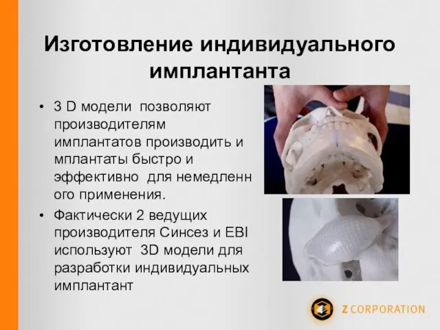 Изготовление индивидуального имплантанта 3 D модели позволяют производителям имплантатов производить имплантаты быстро