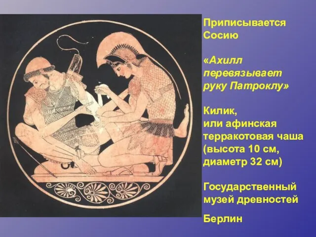 Приписывается Сосию «Ахилл перевязывает руку Патроклу» Килик, или афинская терракотовая чаша (высота