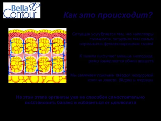 Как это происходит? Ситуация усугубляется тем, что капилляры сжимаются, затрудняя тем самым