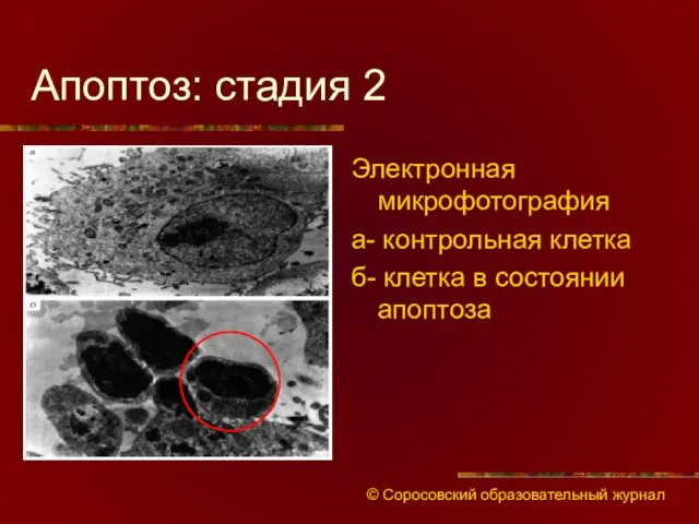 Апоптоз: стадия 2 Электронная микрофотография а- контрольная клетка б- клетка в состоянии