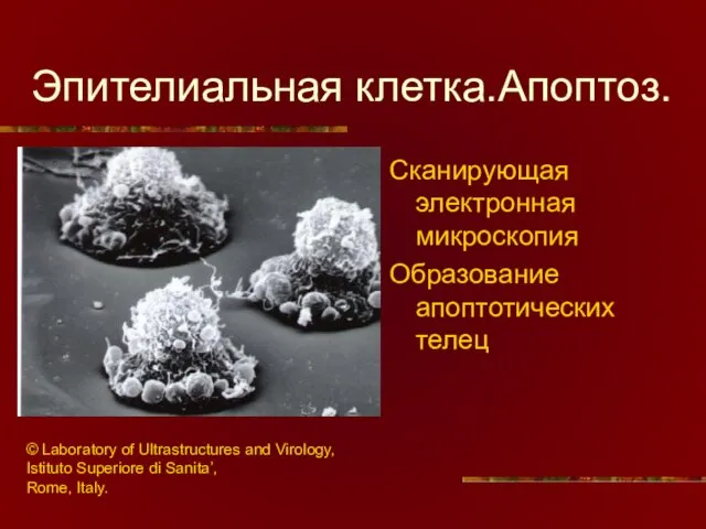 Эпителиальная клетка.Апоптоз. Сканирующая электронная микроскопия Образование апоптотических телец © Laboratory of Ultrastructures