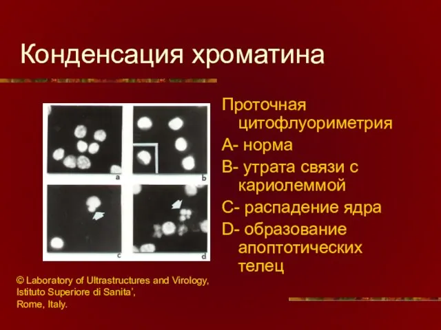 Конденсация хроматина Проточная цитофлуориметрия A- норма B- утрата связи с кариолеммой C-