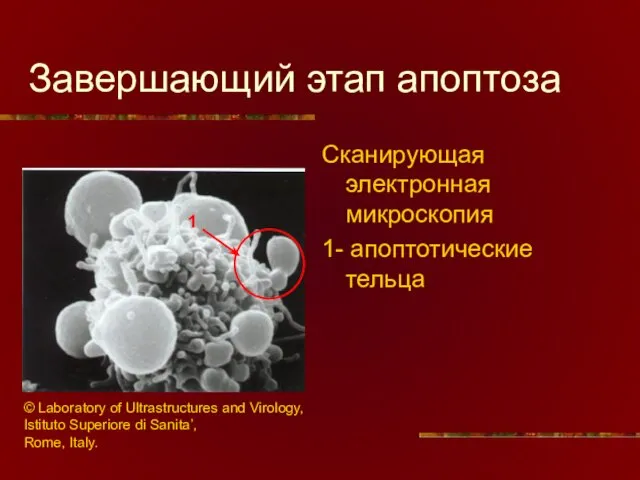 Завершающий этап апоптоза Сканирующая электронная микроскопия 1- апоптотические тельца 1 © Laboratory