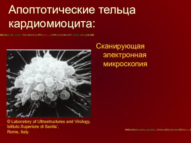 Апоптотические тельца кардиомиоцита: Сканирующая электронная микроскопия © Laboratory of Ultrastructures and Virology,