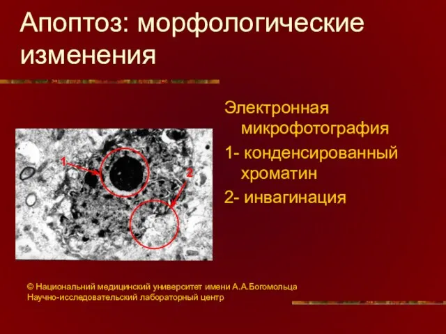 Апоптоз: морфологические изменения Электронная микрофотография 1- конденсированный хроматин 2- инвагинация 2 1