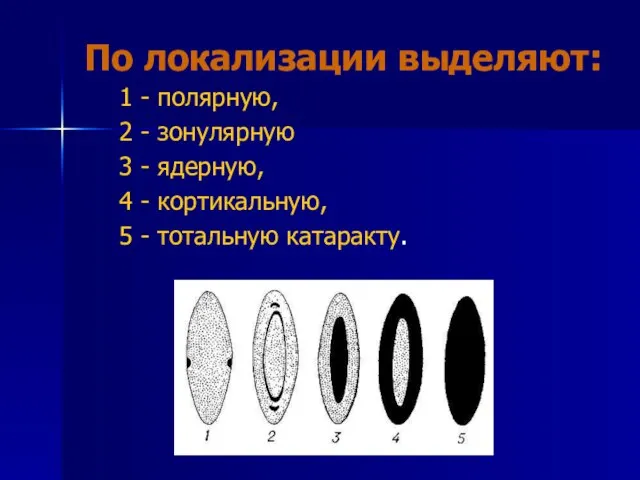 По локализации выделяют: 1 - полярную, 2 - зонулярную 3 - ядерную,