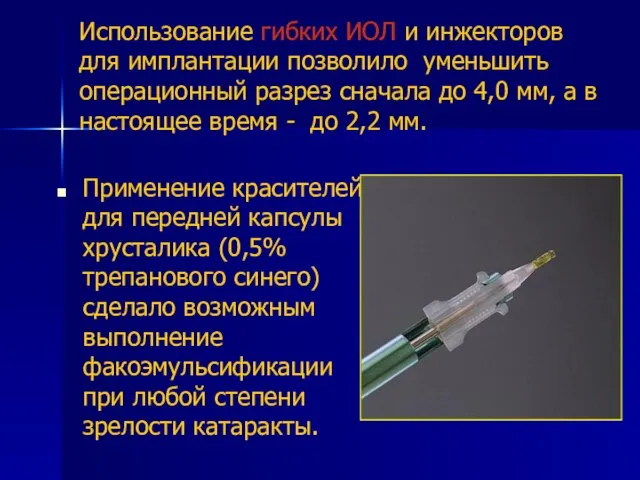 Использование гибких ИОЛ и инжекторов для имплантации позволило уменьшить операционный разрез сначала