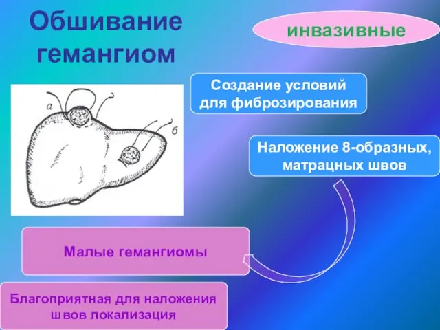 Обшивание гемангиом инвазивные Создание условий для фиброзирования Наложение 8-образных, матрацных швов Малые