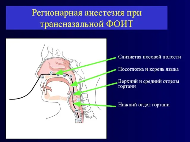 Слизистая носовой полости Носоглотка и корень языка Верхний и средний отделы гортани