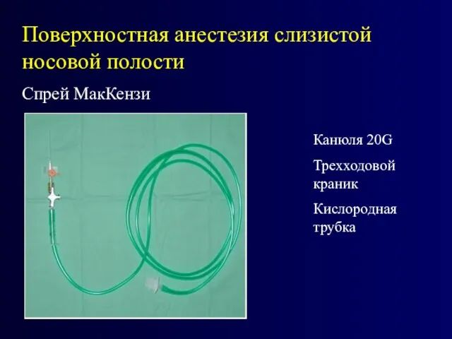 Поверхностная анестезия слизистой носовой полости Спрей МакКензи Канюля 20G Трехходовой краник Кислородная трубка