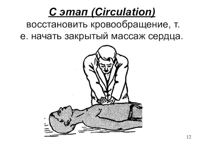 C этап (Circulation) восстановить кровообращение, т. е. начать закрытый массаж сердца. 12