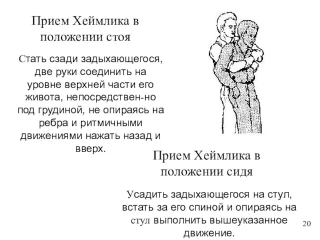 Прием Хеймлика в положении стоя Стать сзади задыхающегося, две руки соединить на