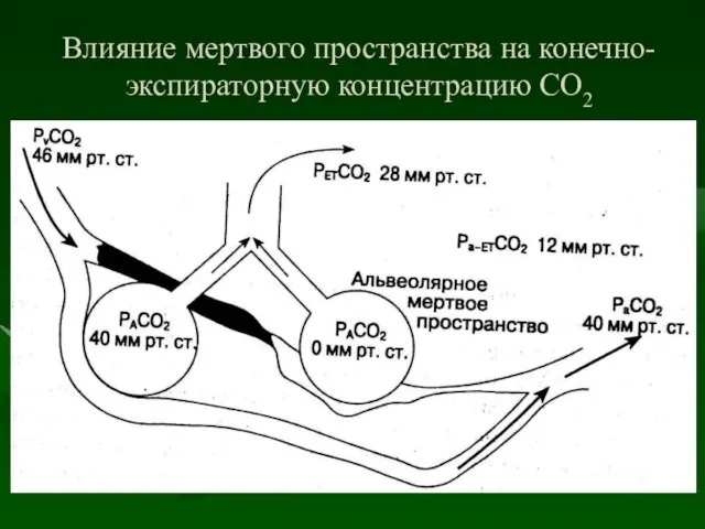 Влияние мертвого пространства на конечно-экспираторную концентрацию СО2