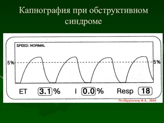 Капнография при обструктивном синдроме По Шурыгину И.А., 2000