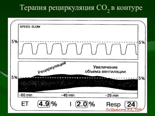 Терапия рециркуляция СО2 в контуре По Шурыгину И.А., 2000