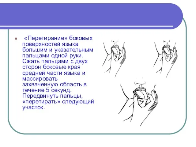 «Перетирание» боковых поверхностей языка большим и указательным паль­цами одной руки. Сжать пальцами