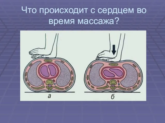 Что происходит с сердцем во время массажа?