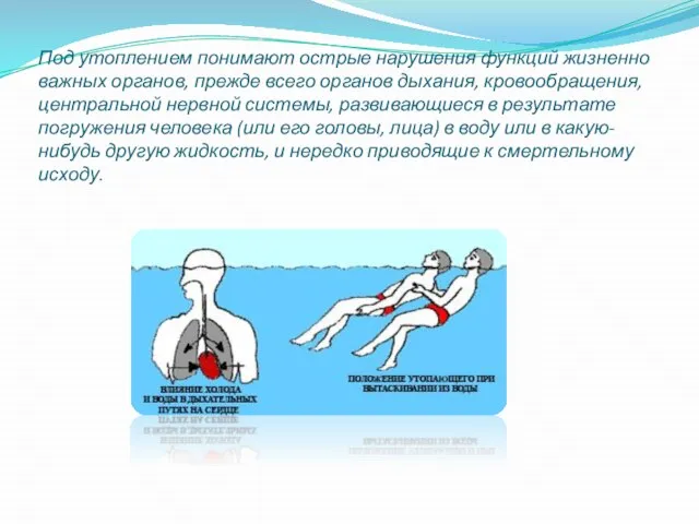 Под утоплением понимают острые нарушения функций жизненно важных органов, прежде всего органов