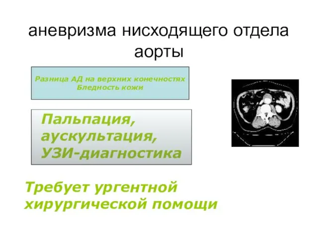 аневризма нисходящего отдела аорты Пальпация, аускультация, УЗИ-диагностика Разница АД на верхних конечностях