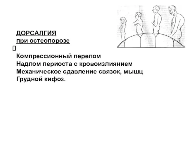 ДОРСАЛГИЯ при остеопорозе Компрессионный перелом Надлом периоста с кровоизлиянием Механическое сдавление связок, мышц Грудной кифоз.