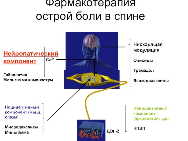 Фармакотерапия острой боли в спине Нисходящая модуляция Опиоиды Трамадол Бензодиазепины Нейропатический компонент