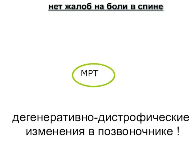 дегенеративно-дистрофические изменения в позвоночнике ! МРТ нет жалоб на боли в спине