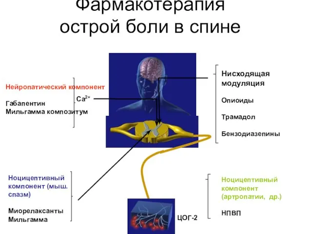 Фармакотерапия острой боли в спине Нисходящая модуляция Опиоиды Трамадол Бензодиазепины Нейропатический компонент
