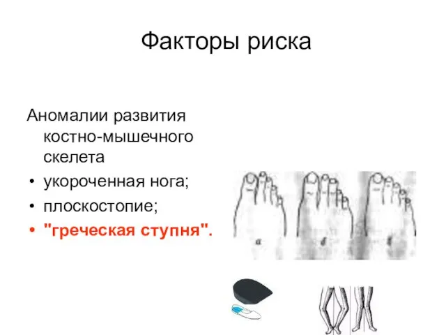 Факторы риска Аномалии развития костно-мышечного скелета укороченная нога; плоскостопие; "греческая ступня".