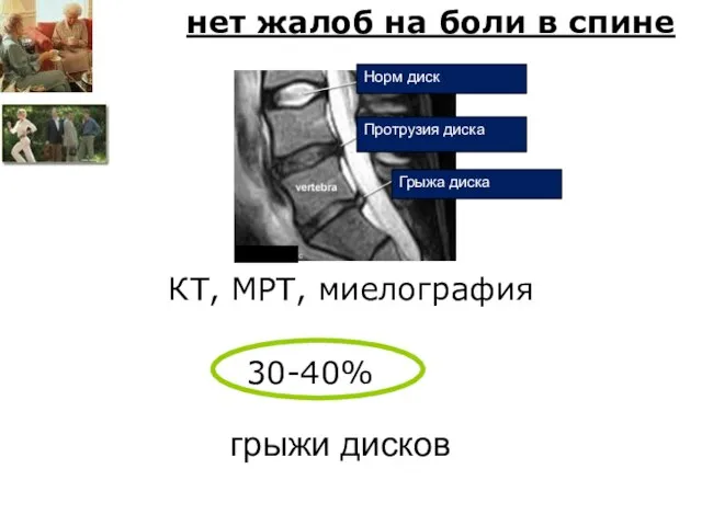 грыжи дисков Норм диск Протрузия диска Грыжа диска нет жалоб на боли
