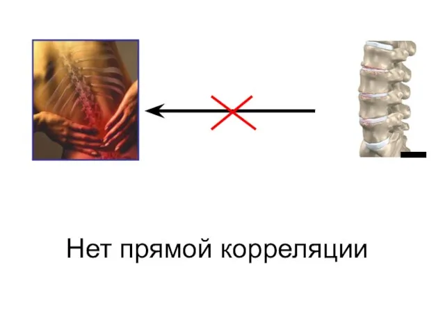 Нет прямой корреляции