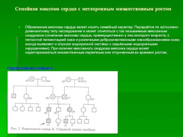 Семейная миксома сердца с метахронным множественным ростом Образование миксомы сердца может носить