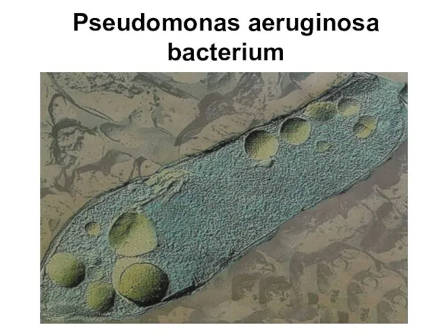 Pseudomonas aeruginosa bacterium