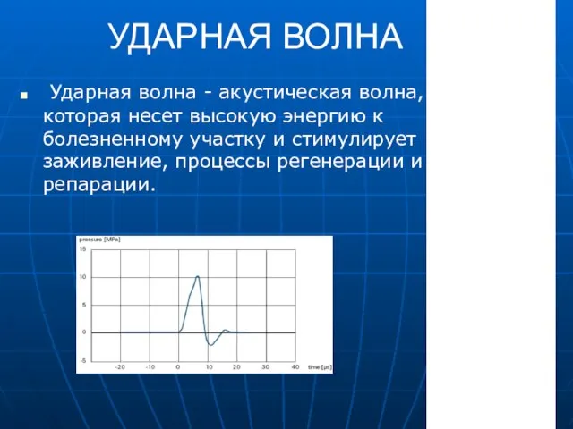 УДАРНАЯ ВОЛНА Ударная волна - акустическая волна, которая несет высокую энергию к