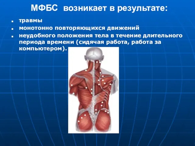 МФБС возникает в результате: травмы монотонно повторяющихся движений неудобного положения тела в