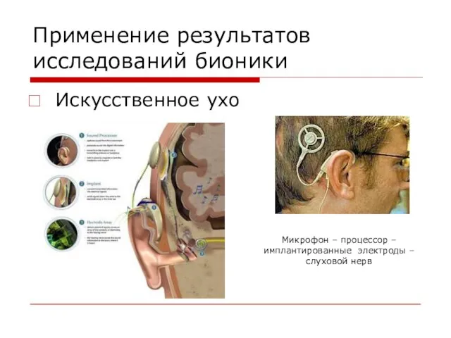 Применение результатов исследований бионики Искусственное ухо Микрофон – процессор – имплантированные электроды – слуховой нерв