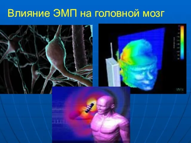 Влияние ЭМП на головной мозг