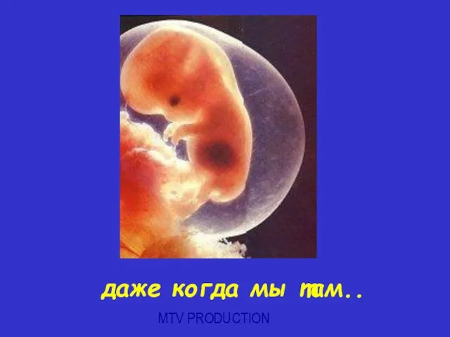 MTV PRODUCTION даже когда мы там..