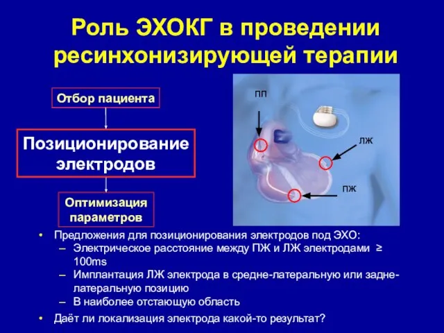 Роль ЭХОКГ в проведении ресинхонизирующей терапии Отбор пациента Позиционирование электродов Оптимизация параметров