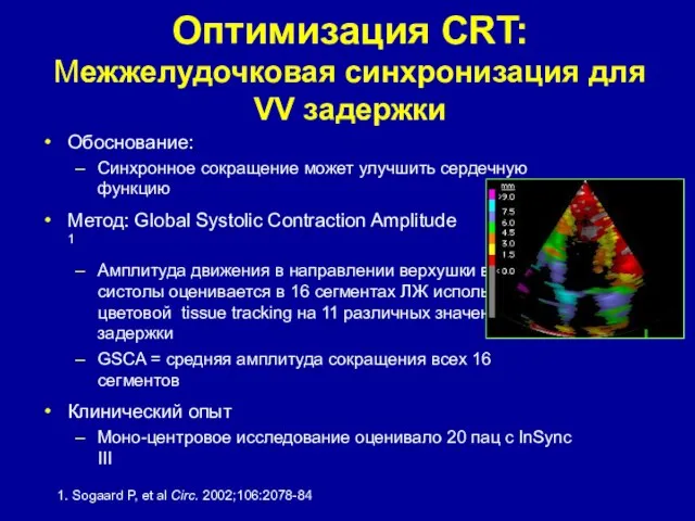 Оптимизация CRT: Межжелудочковая синхронизация для VV задержки Обоснование: Синхронное сокращение может улучшить